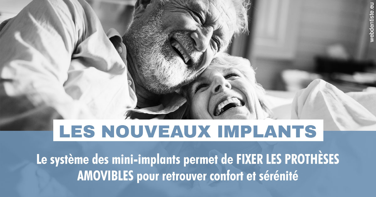 https://scp-des-docteurs-ollu-et-renaud.chirurgiens-dentistes.fr/Les nouveaux implants 2