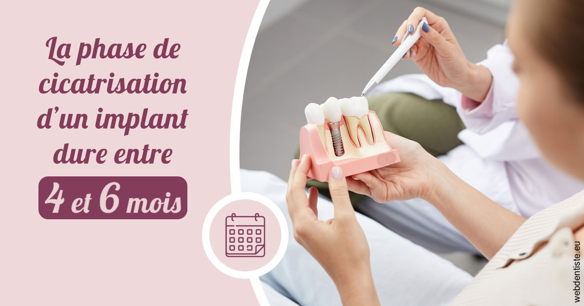 https://scp-des-docteurs-ollu-et-renaud.chirurgiens-dentistes.fr/Cicatrisation implant 2