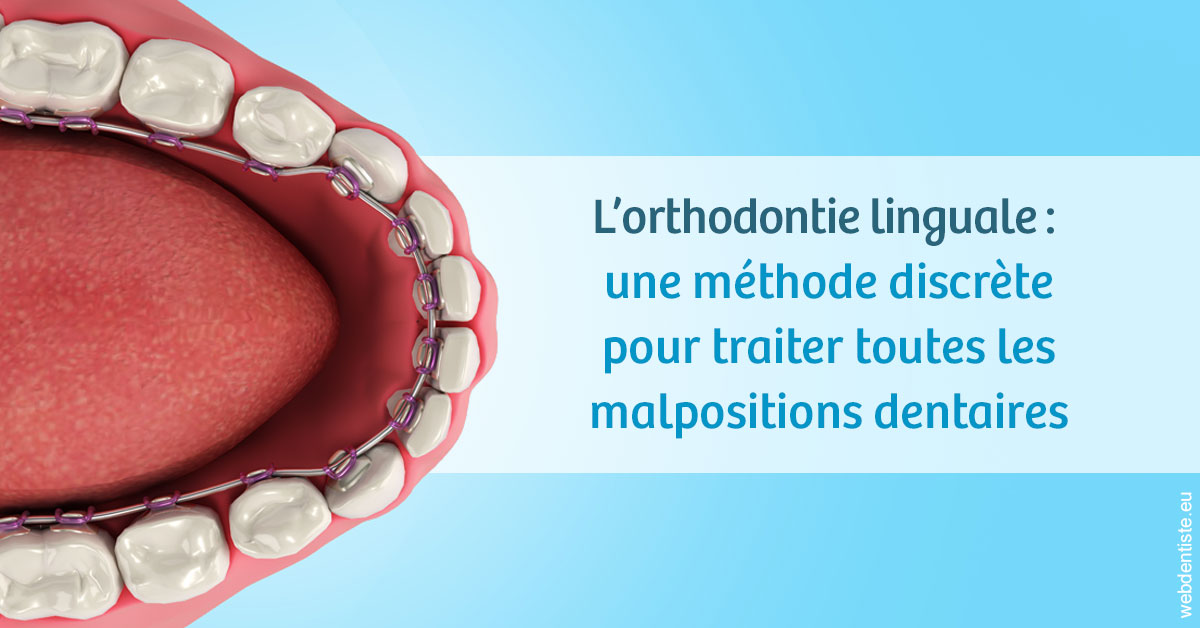 https://scp-des-docteurs-ollu-et-renaud.chirurgiens-dentistes.fr/L'orthodontie linguale 1