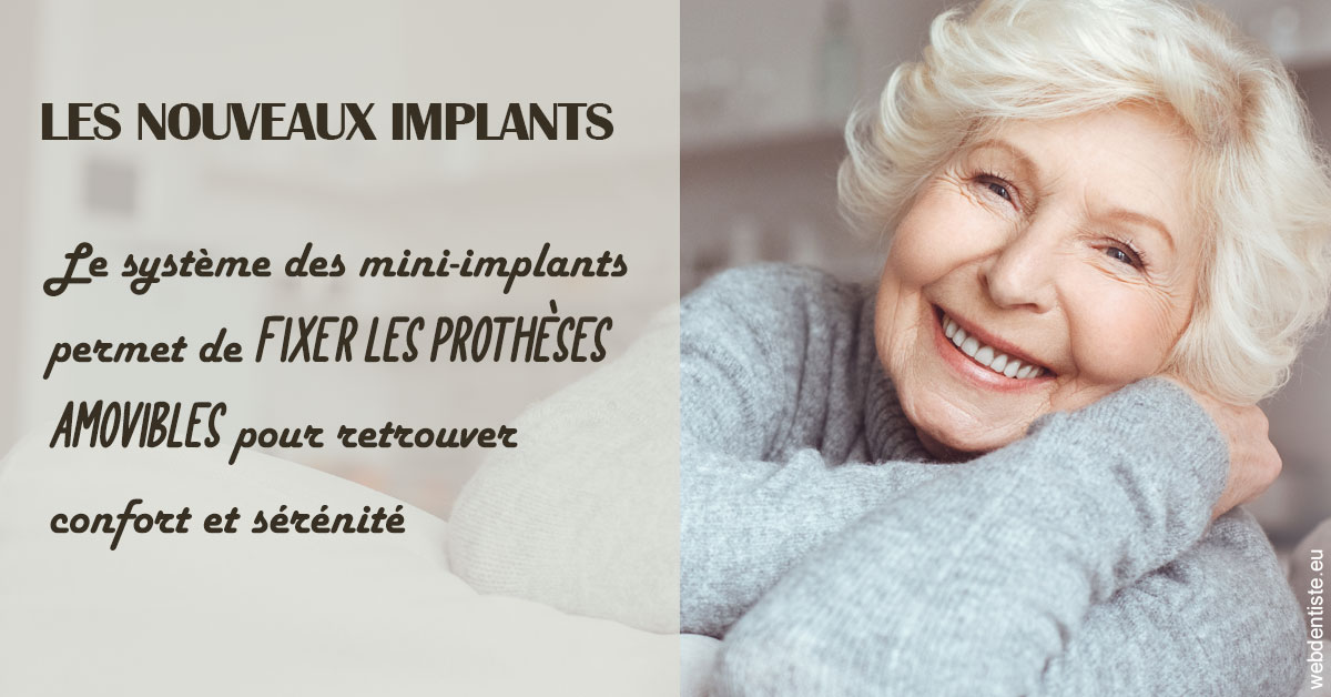 https://scp-des-docteurs-ollu-et-renaud.chirurgiens-dentistes.fr/Les nouveaux implants 1