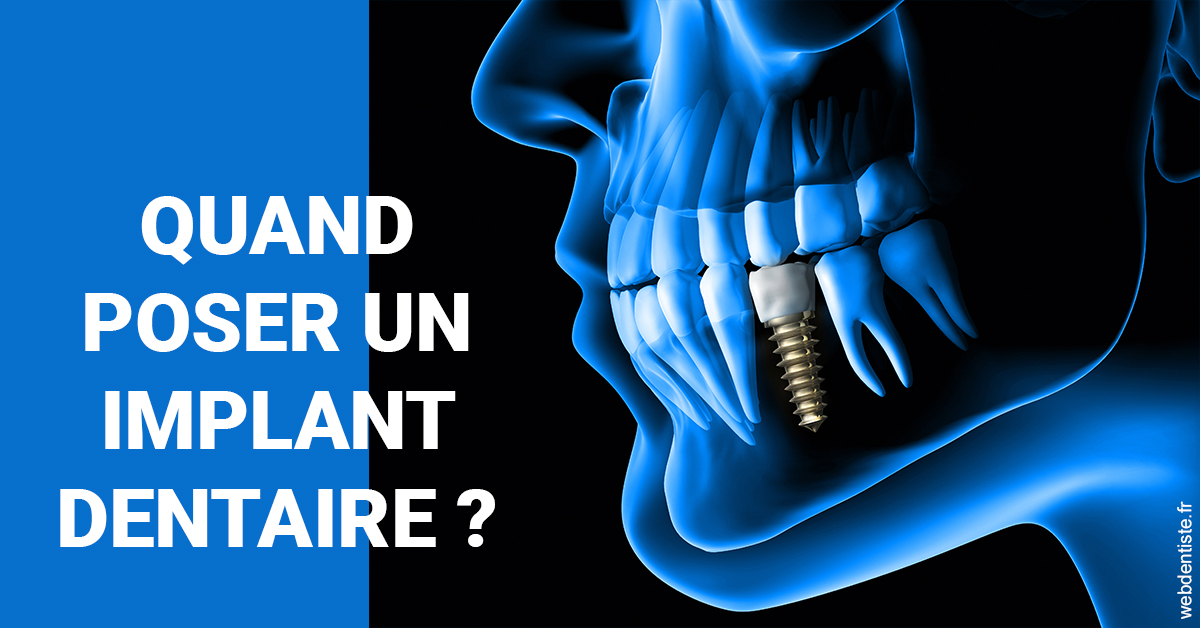 https://scp-des-docteurs-ollu-et-renaud.chirurgiens-dentistes.fr/Les implants 1