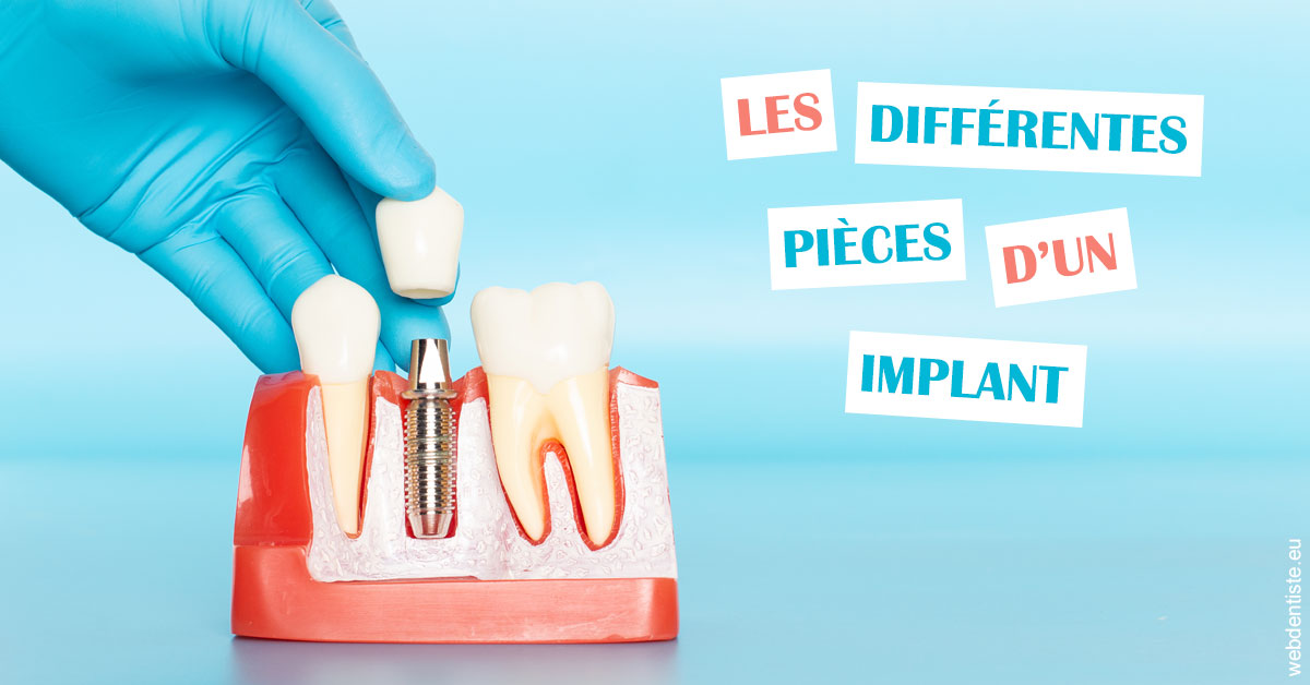 https://scp-des-docteurs-ollu-et-renaud.chirurgiens-dentistes.fr/Les différentes pièces d’un implant 2