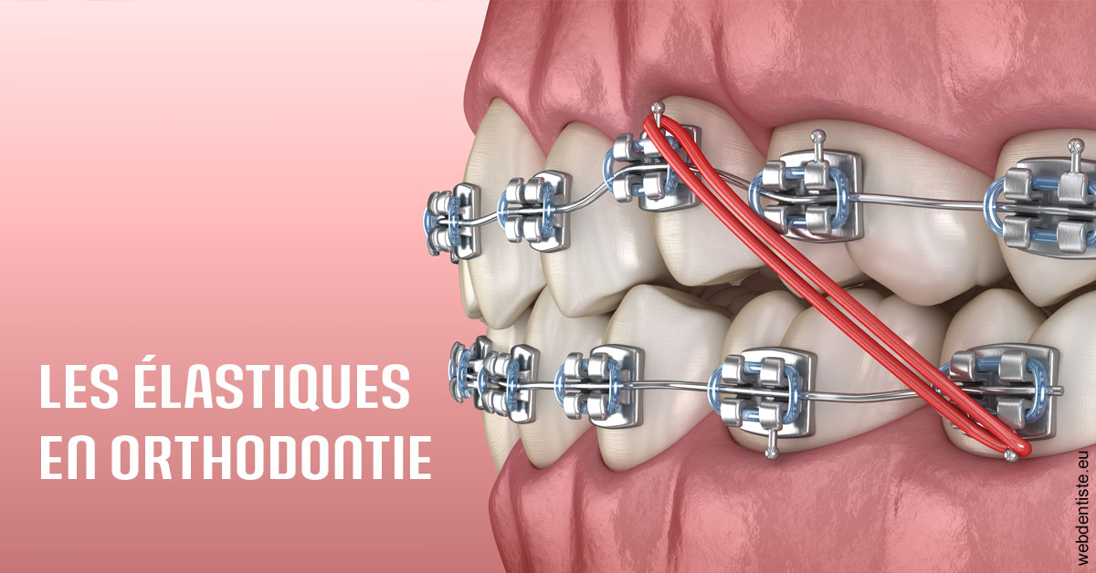 https://scp-des-docteurs-ollu-et-renaud.chirurgiens-dentistes.fr/Elastiques orthodontie 2