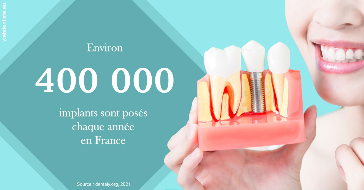 https://scp-des-docteurs-ollu-et-renaud.chirurgiens-dentistes.fr/Pose d'implants en France 2